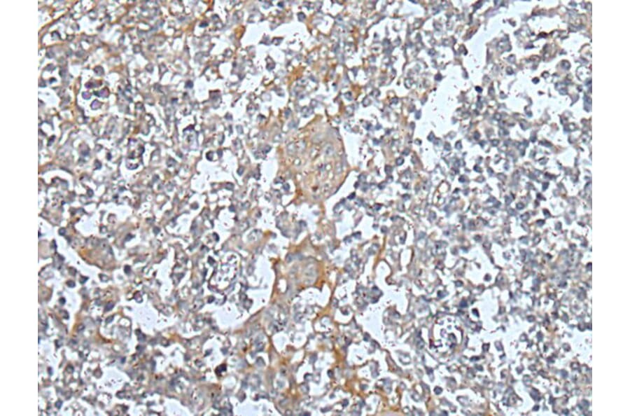 KIF14 Antibody from Signalway Antibody (43741) - Antibodies.com