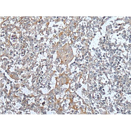 KIF14 Antibody from Signalway Antibody (43741) - Antibodies.com