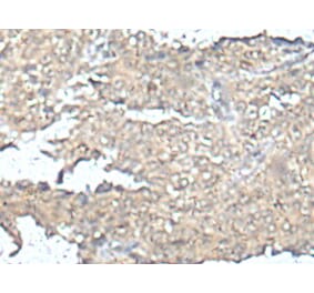 MEF2D Antibody from Signalway Antibody (43752) - Antibodies.com