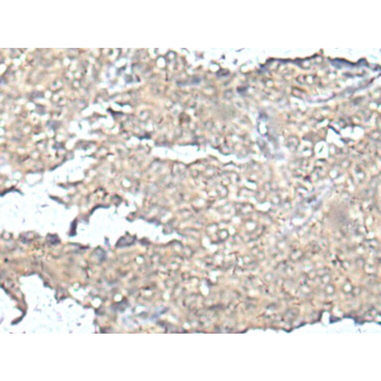 MEF2D Antibody from Signalway Antibody (43752) - Antibodies.com