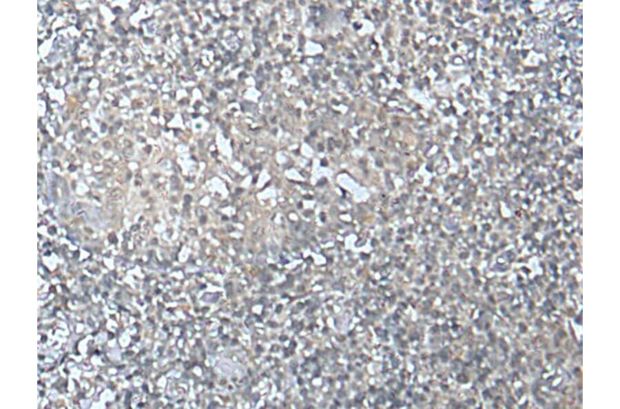 MEF2D Antibody from Signalway Antibody (43752) - Antibodies.com