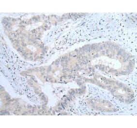 ITGA8 Antibody from Signalway Antibody (43756) - Antibodies.com