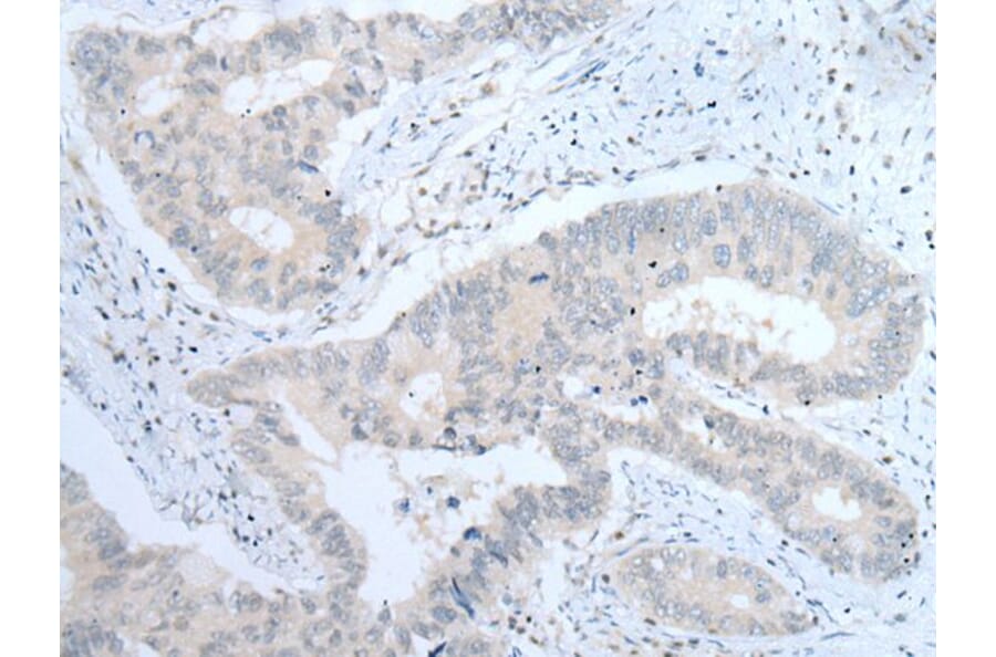 ITGA8 Antibody from Signalway Antibody (43756) - Antibodies.com