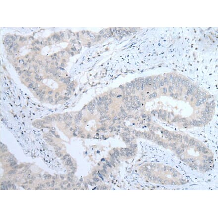 ITGA8 Antibody from Signalway Antibody (43756) - Antibodies.com