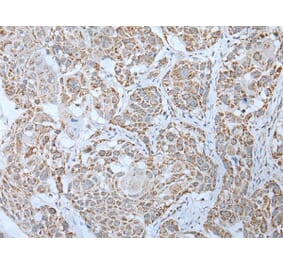 LHCGR Antibody from Signalway Antibody (43757) - Antibodies.com
