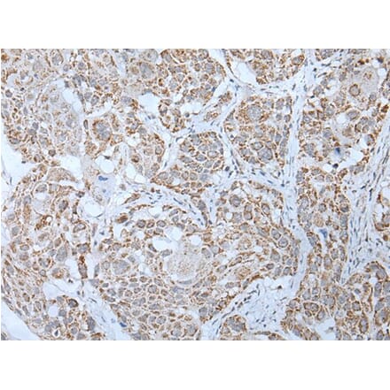 LHCGR Antibody from Signalway Antibody (43757) - Antibodies.com