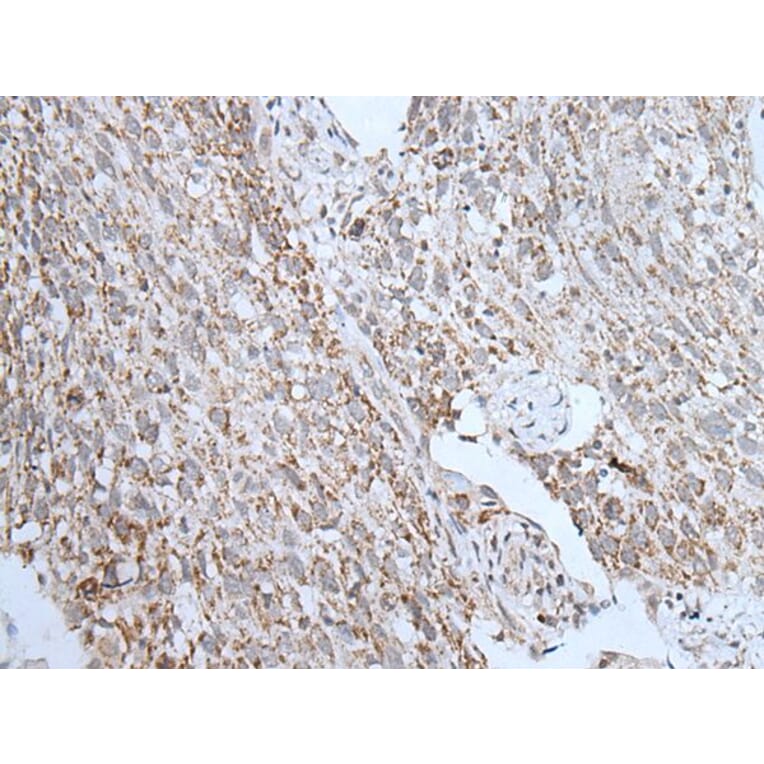 LHCGR Antibody from Signalway Antibody (43757) - Antibodies.com