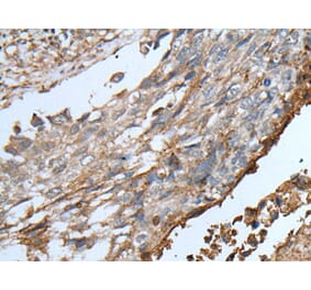 KLRK1 Antibody from Signalway Antibody (43762) - Antibodies.com