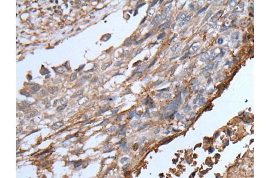 KLRK1 Antibody from Signalway Antibody (43762) - Antibodies.com