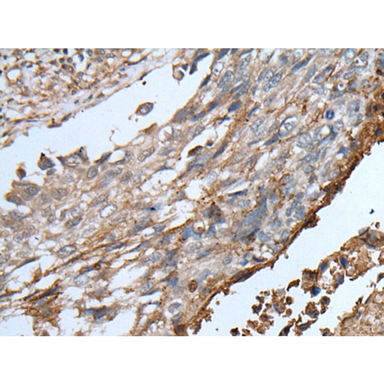 KLRK1 Antibody from Signalway Antibody (43762) - Antibodies.com