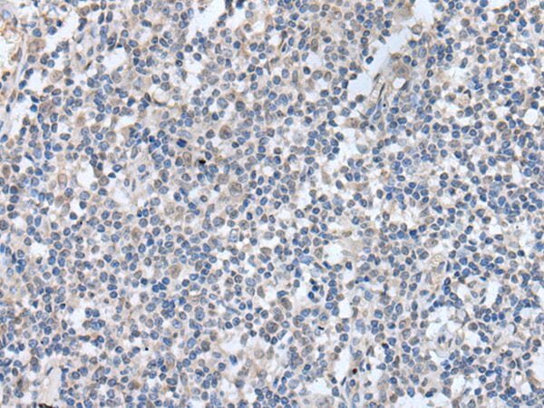 The image on the left is immunohistochemistry of paraffin-embedded Human tonsil tissue using KCNQ3 Antibody at dilution 1/30, on the right is treated with synthetic peptide. (Original magnification: x200)