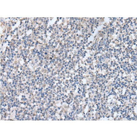 KCNQ3 Antibody from Signalway Antibody (43764) - Antibodies.com