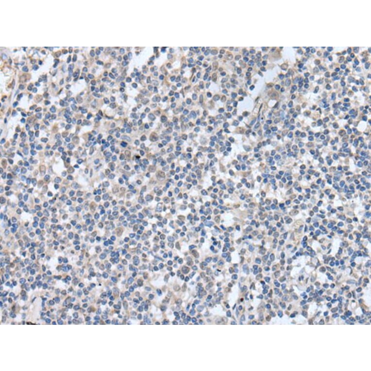 KCNQ3 Antibody from Signalway Antibody (43764) - Antibodies.com