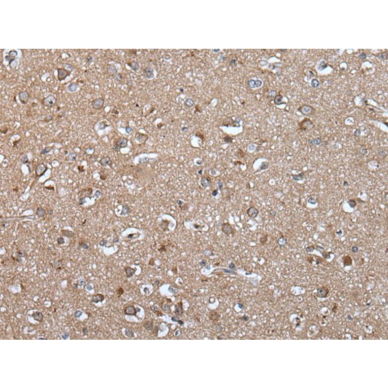 EPHA5 Antibody from Signalway Antibody (43770) - Antibodies.com