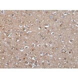 EPHA5 Antibody from Signalway Antibody (43770) - Antibodies.com
