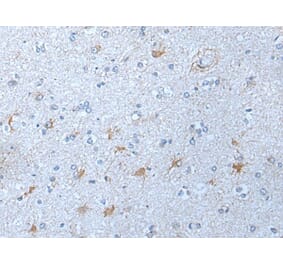 KLK12 Antibody from Signalway Antibody (43777) - Antibodies.com