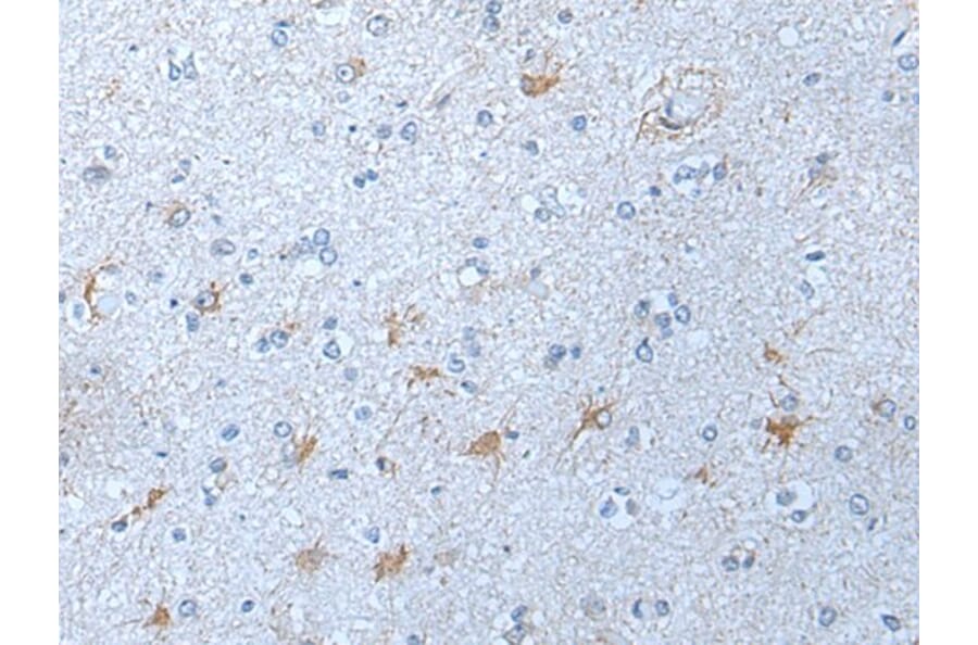 KLK12 Antibody from Signalway Antibody (43777) - Antibodies.com