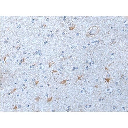 KLK12 Antibody from Signalway Antibody (43777) - Antibodies.com