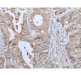 NUP88 Antibody from Signalway Antibody (43779) - Antibodies.com