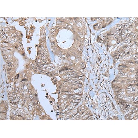 NUP88 Antibody from Signalway Antibody (43779) - Antibodies.com