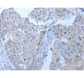 YPEL4 Antibody from Signalway Antibody (43796) - Antibodies.com