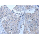 YPEL4 Antibody from Signalway Antibody (43796) - Antibodies.com