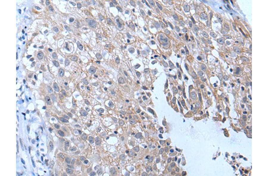 YPEL4 Antibody from Signalway Antibody (43796) - Antibodies.com
