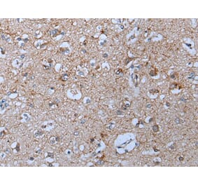 YPEL5 Antibody from Signalway Antibody (43797) - Antibodies.com