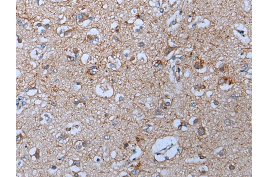 YPEL5 Antibody from Signalway Antibody (43797) - Antibodies.com