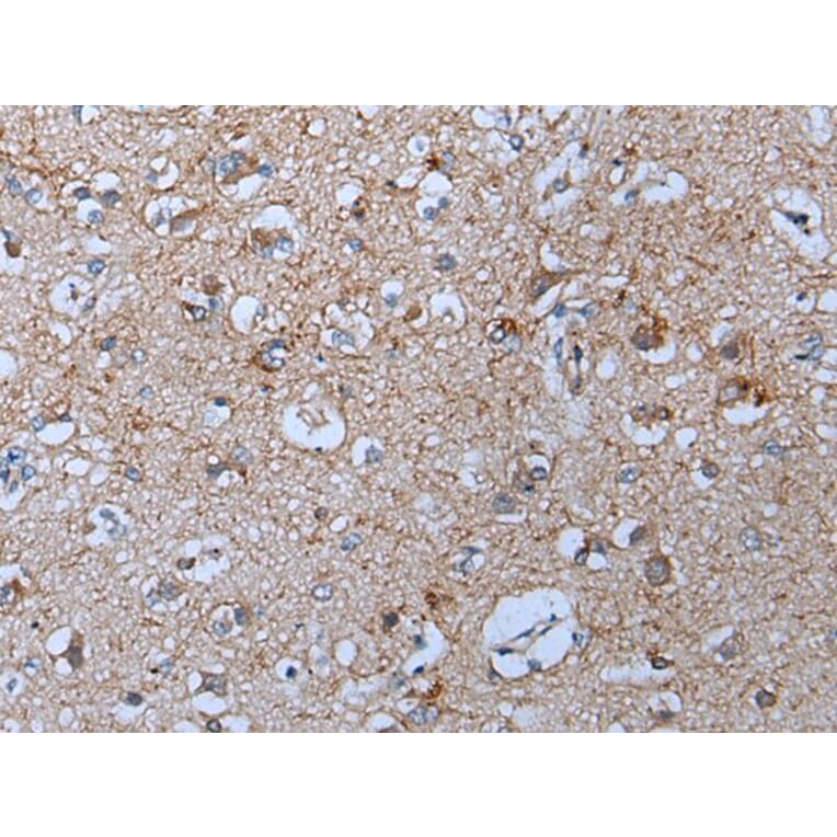 YPEL5 Antibody from Signalway Antibody (43797) - Antibodies.com