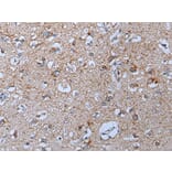 YPEL5 Antibody from Signalway Antibody (43797) - Antibodies.com