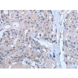 YPEL5 Antibody from Signalway Antibody (43797) - Antibodies.com