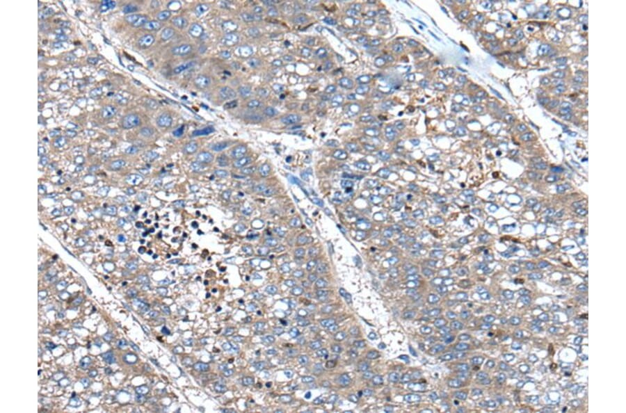 XIRP1 Antibody from Signalway Antibody (43801) - Antibodies.com