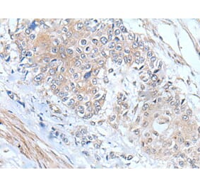 MIEN1 Antibody from Signalway Antibody (43804) - Antibodies.com