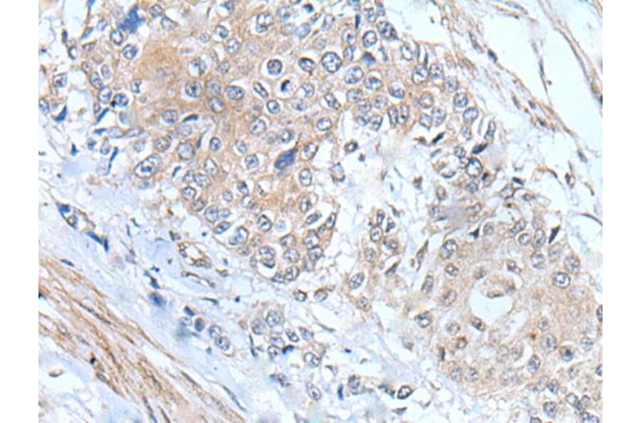 MIEN1 Antibody from Signalway Antibody (43804) - Antibodies.com