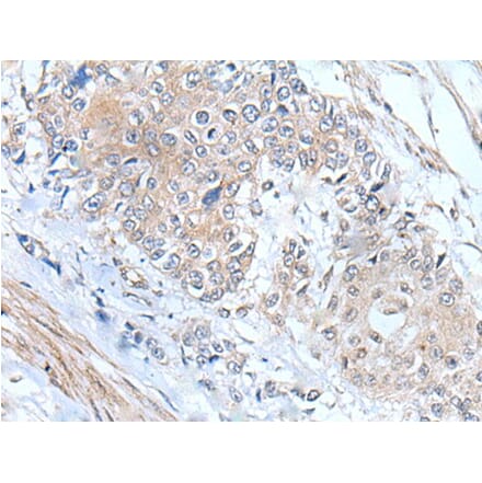 MIEN1 Antibody from Signalway Antibody (43804) - Antibodies.com