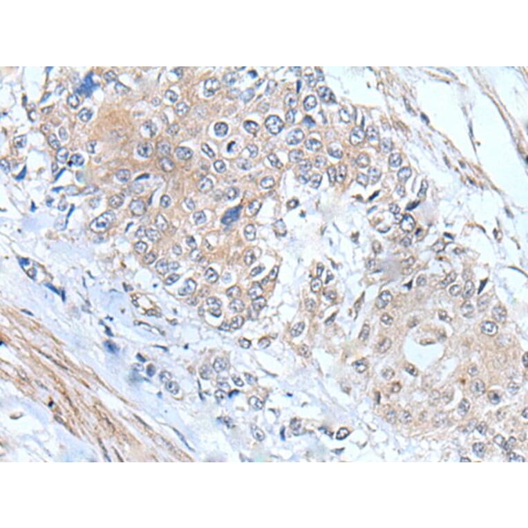 MIEN1 Antibody from Signalway Antibody (43804) - Antibodies.com