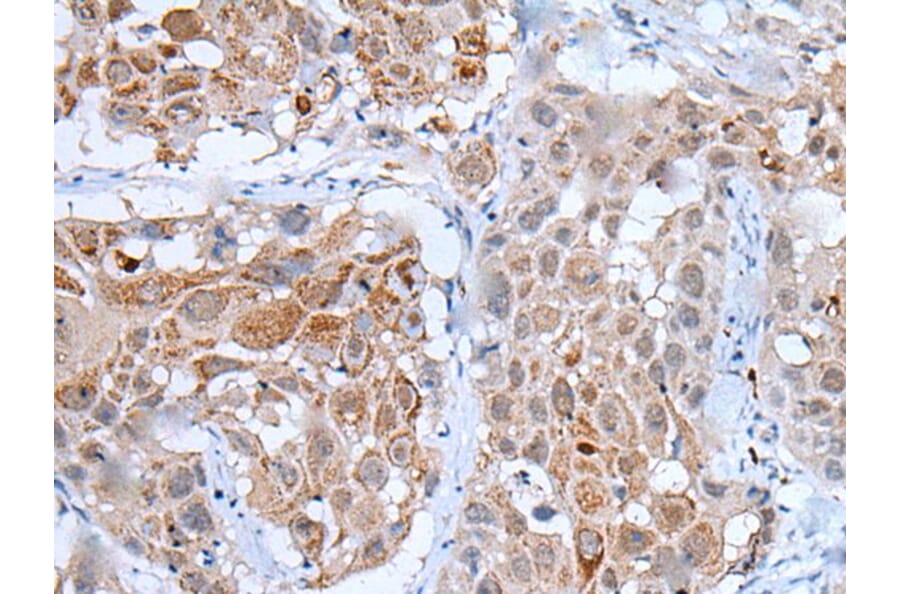 WDHD1 Antibody from Signalway Antibody (43805) - Antibodies.com