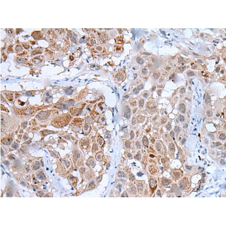 WDHD1 Antibody from Signalway Antibody (43805) - Antibodies.com