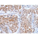 WDHD1 Antibody from Signalway Antibody (43805) - Antibodies.com