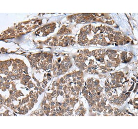 WHSC1 Antibody from Signalway Antibody (43810) - Antibodies.com