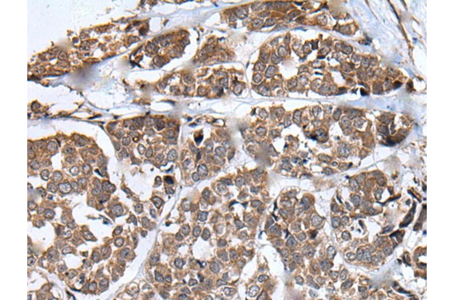 WHSC1 Antibody from Signalway Antibody (43810) - Antibodies.com