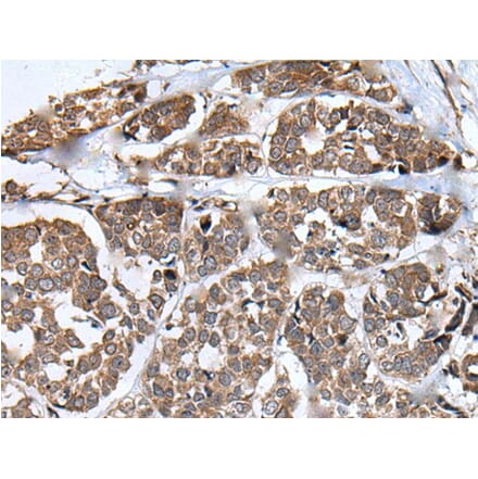 WHSC1 Antibody from Signalway Antibody (43810) - Antibodies.com