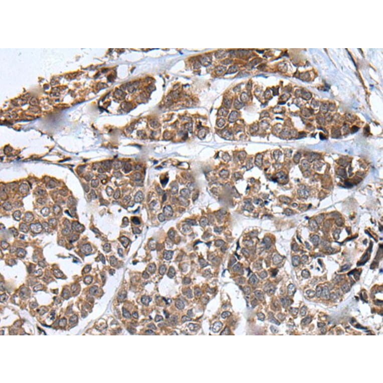 WHSC1 Antibody from Signalway Antibody (43810) - Antibodies.com