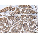 WHSC1 Antibody from Signalway Antibody (43810) - Antibodies.com