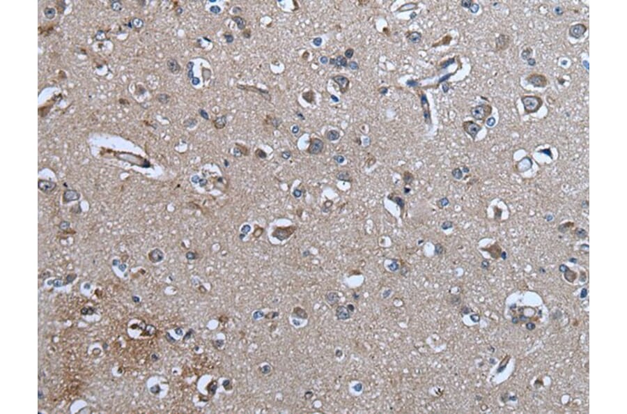 WISP3 Antibody from Signalway Antibody (43816) - Antibodies.com