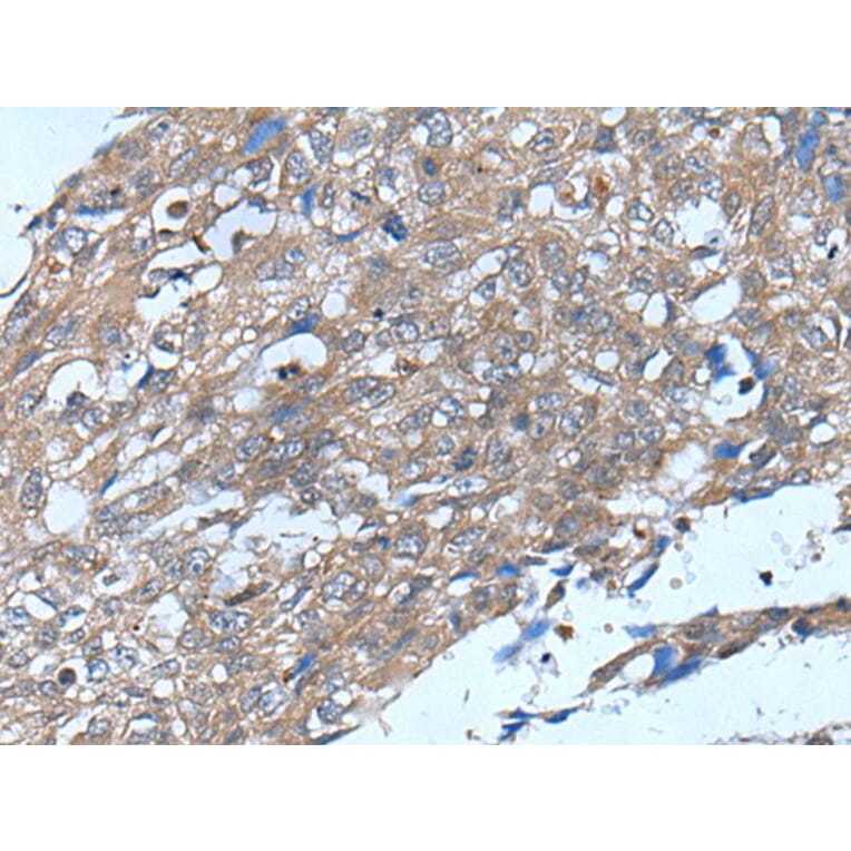 VSIG1 Antibody from Signalway Antibody (43826) - Antibodies.com