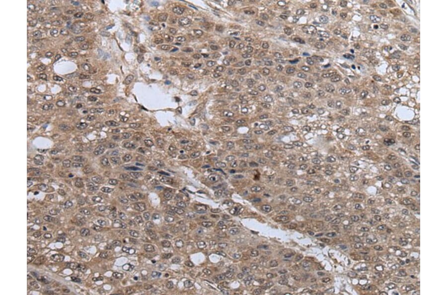 UBE4B Antibody from Signalway Antibody (43828) - Antibodies.com