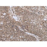 UBE4B Antibody from Signalway Antibody (43828) - Antibodies.com