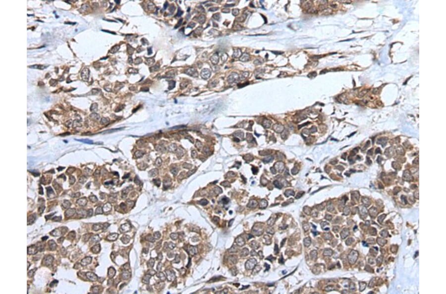UBE4B Antibody from Signalway Antibody (43828) - Antibodies.com
